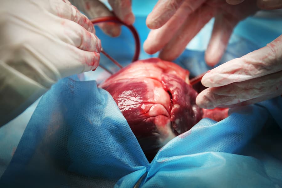 Doctor Haciendo Operacion Corazon