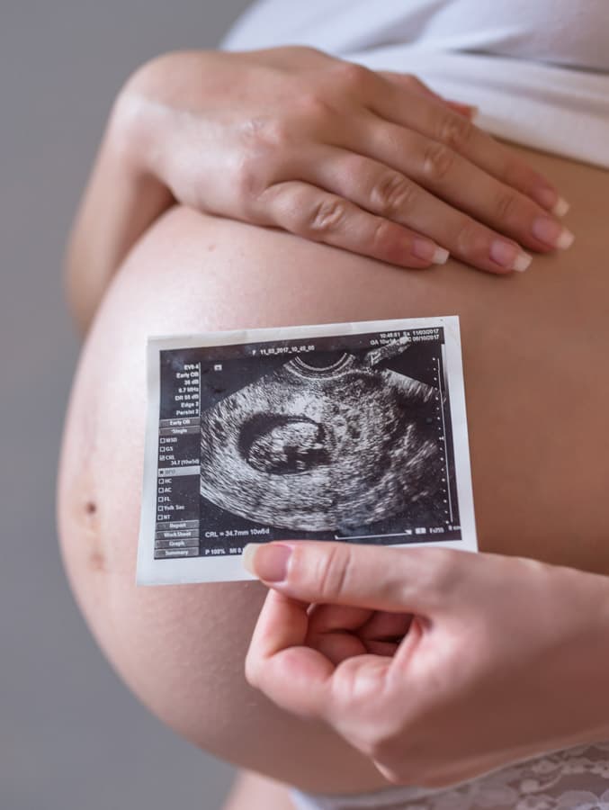 Mujer Embarazada Foto Su Futuro Bebe 1